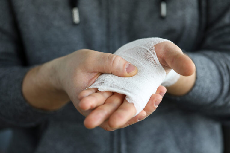 Picture of a man holding his injured hand, which is wrapped in gauze.