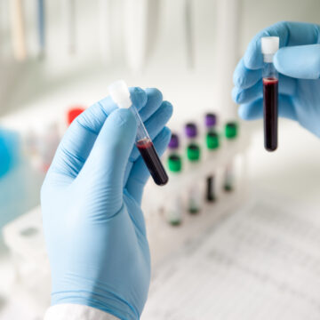 Picture of a medical provider holding test tubes used for diagnostic testing.